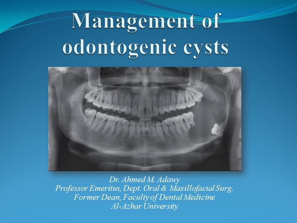 Management of odontogenic cysts
